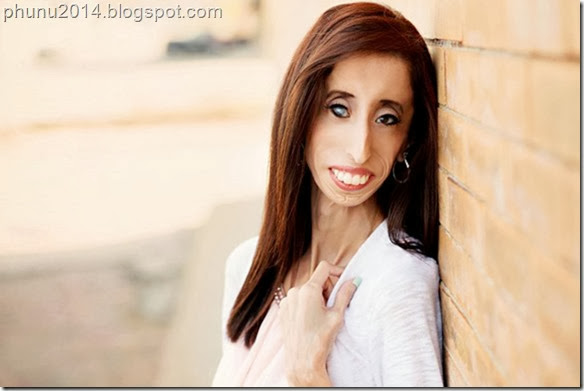 Lizzie1 Lizzie1