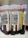 Blood Test