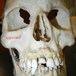 skull_maxilla_labeled.JPG