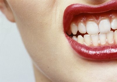 [%25C3%25B3dio%255B3%255D.jpg]