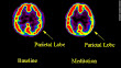 Brain On Meditation