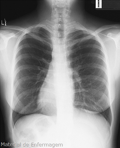 [X-Ray%255B19%255D.jpg]