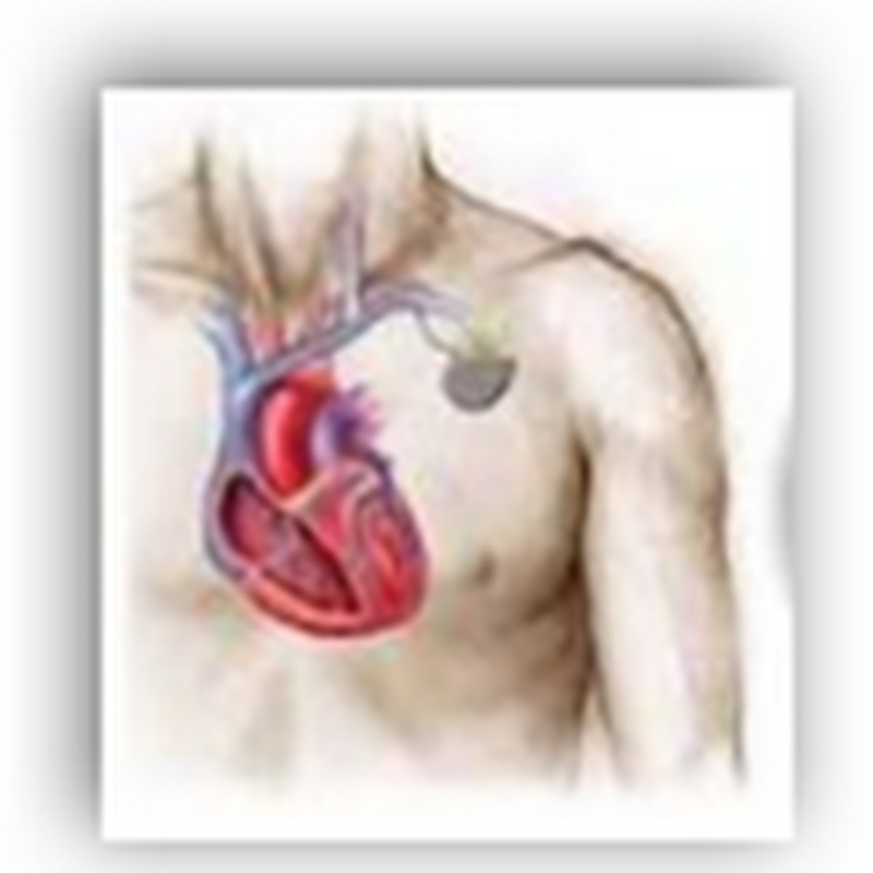 Man Tries to Remove His Pacemaker Himself - Ends Up Dead in the Process
