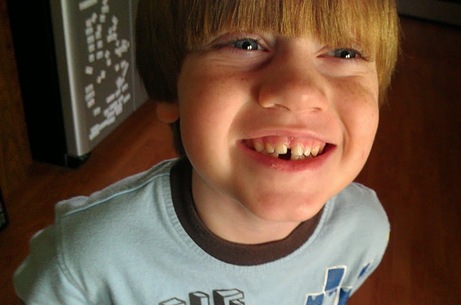Aikman lost tooth