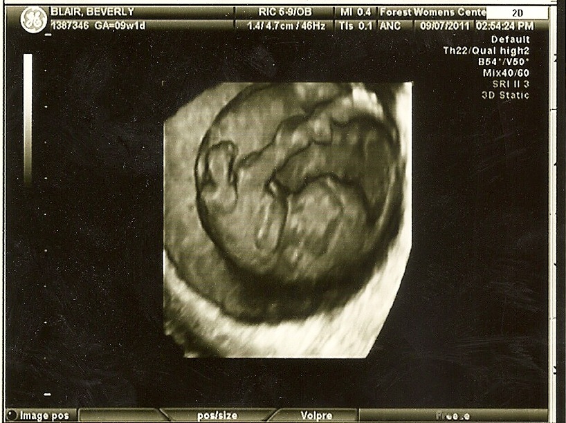 [scan0054%255B2%255D.jpg]