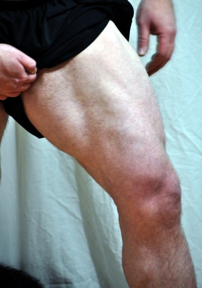 [01-21-2012_WheelMed%255B1%255D.jpg]