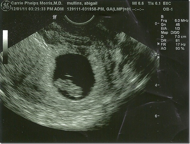 baby boy 10003