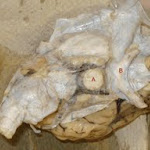 brain_dissect03.jpg brain_dissect03.jpg