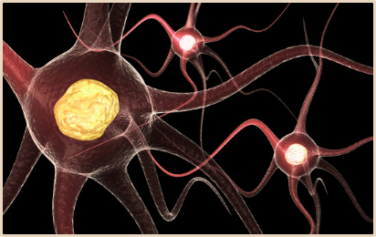 What is Parkinson s Disease