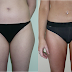 Lipo3.png