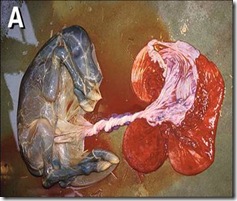 placenta-Diffused type