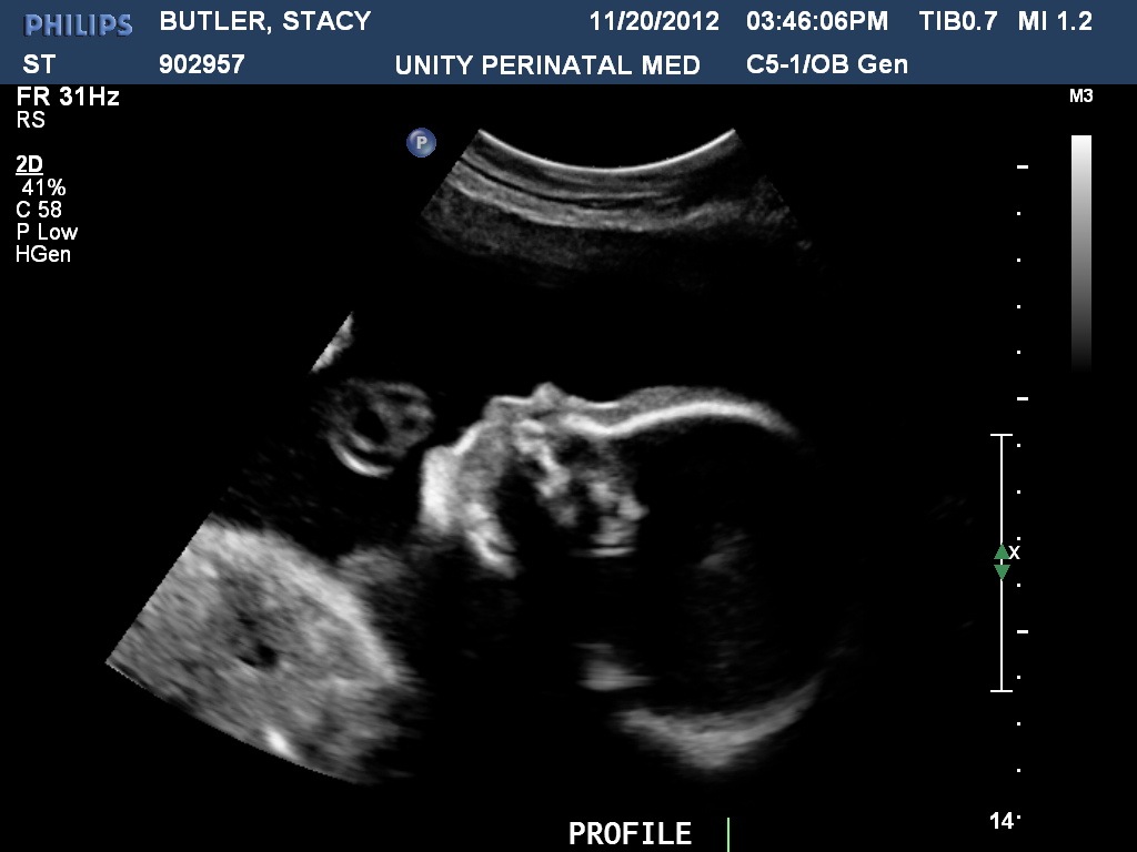 [BUTLERSTACY20121120154606747%255B3%255D.jpg]