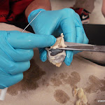 eye_removal_of_fat.JPG