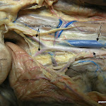iliac_L.JPG