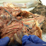 brachiocephalic_artery.JPG