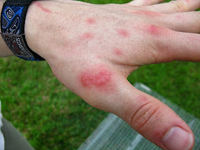 Plant Rash
