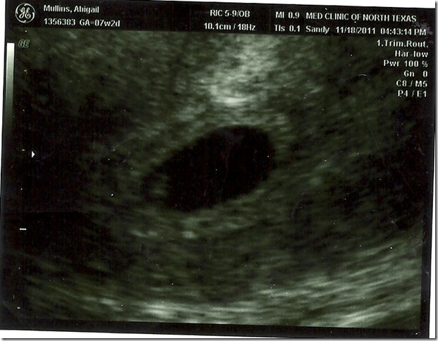 baby boy 10001