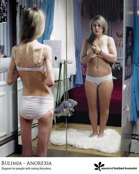 [anorexia-y-bulimia%255B11%255D.jpg]
