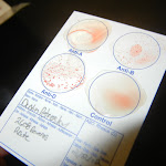 blood_cross_contamination.JPG