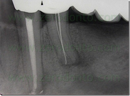 FIG N 39