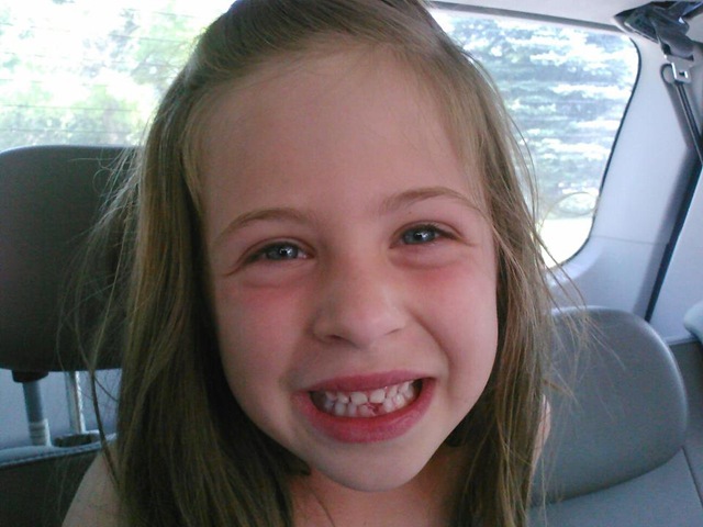 [chloe%2520tooth%255B3%255D.jpg]