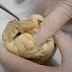 z_pulmonary_trunk.JPG