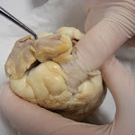 z_pulmonary_trunk.JPG