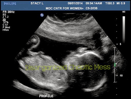 Baby #4 Baby #4