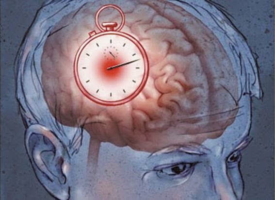 10 способов защиты от инсульта 10 способов защиты от инсульта