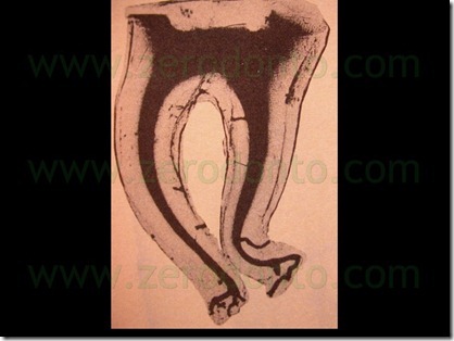 FIG N 30