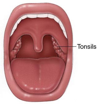 [tonsils4.jpg]