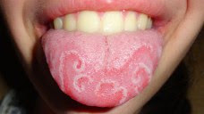 10-Weird-But-Real-Medical-Conditions-08-722x406