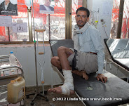 He was hit by a mortar when marching from Taiz to Sana'a and he has the video to prove it.