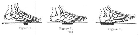 Nett Foot Strikes