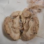 brain_lateral_incision.JPG