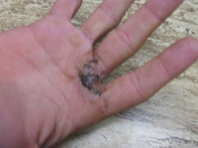 [hand18.jpg]