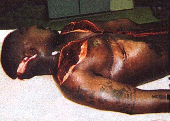 autopsy autopsy