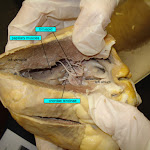 This heart was cut straight down, from the aorta then through the left atrium and left ventricle. When you pull the heart open you can see the bicuspid valve. heart_left_ventricle_labeled.jpg