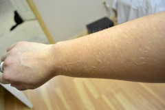 [itchy%2520arm%255B4%255D.jpg]