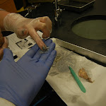 vitreous_fluid_in_hand.JPG