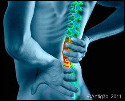 hernia de disco hernia de disco