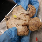 brain_pineal_revealed.JPG