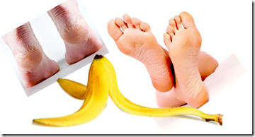 รักษาส้นเท้าแตกด้วยเปลือกกล้วยหอม