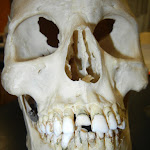 skull_maxilla - Copy.JPG