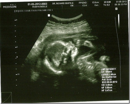 scan0005