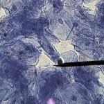 cell_cheek_05_400x.jpg