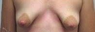beforeandafter.jpg