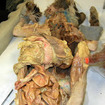 pancreas.JPG