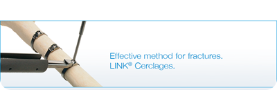 Bone Fixation Cerclage