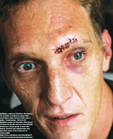 [Shawinsky%2520Brendon%252033%2520building%2520contractor%2520%2520badly%2520beaten%2520knifed%2520SecondAvenueCafee%2520Bloemfontein%255B5%255D.jpg]